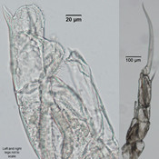Male 5th leg Hesperodiaptomus shoshone