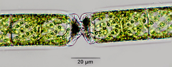 Phycokey - Spirogyra images